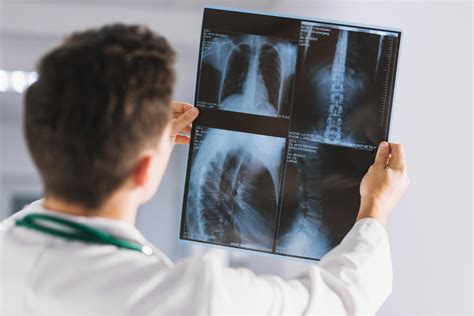 Como Ser Uma Enfermeira De Radiologia